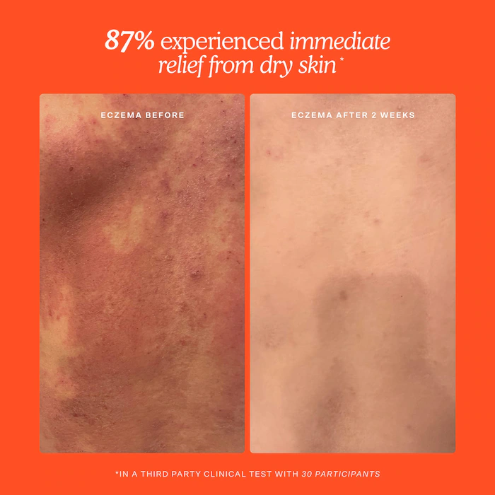 Mini SOS Daily Rescue Facial Spray - Image 10