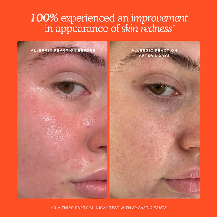 Mini SOS Daily Rescue Facial Spray - Image 8