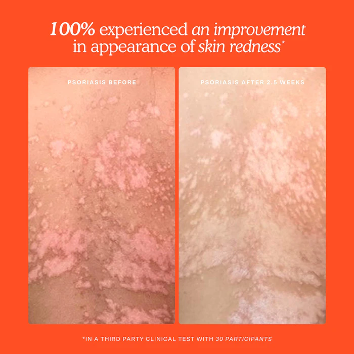 Mini SOS Daily Rescue Facial Spray - Image 7